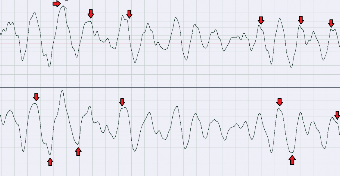 Making use of lower and upper sideband differences